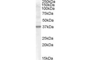 Western Blotting (WB) image for anti-Component of Oligomeric Golgi Complex 6 (COG6) (C-Term) antibody (ABIN2787226) (COG6 antibody  (C-Term))