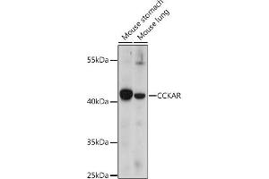 Western blot analysis of extracts of various cell lines, using CCKAR antibody (ABIN7266339) at 1:1000 dilution. (CCKAR antibody  (AA 100-200))