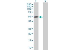 Western Blot analysis of MASP1 expression in transfected 293T cell line by MASP1 MaxPab polyclonal antibody. (MASP1 antibody  (AA 1-380))