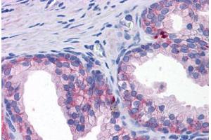 Human Prostate: Formalin-Fixed, Paraffin-Embedded (FFPE) (SLC39A3 antibody  (Internal Region))