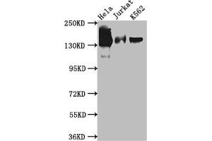 Western Blot Positive WB detected in: Hela whole cell lysate, Jurkat whole cell lysate, K562 whole cell lysate All lanes: SA2 antibody at 1:1000 Secondary Goat polyclonal to rabbit IgG at 1/50000 dilution Predicted band size: 142, 146 kDa Observed band size: 142 kDa (Recombinant STAG2 antibody)