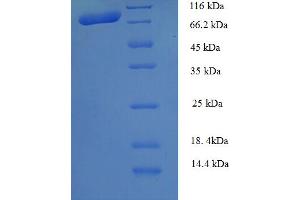 SDS-PAGE (SDS) image for Calpain 1 (CAPN1) (AA 1-714), (full length) protein (His tag) (ABIN5709187) (CAPN1 Protein (AA 1-714, full length) (His tag))