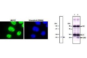 Immunohistochemistry (IHC) image for anti-Small Nuclear Ribonucleoprotein Polypeptide C (SNRPC) (full length) antibody (ABIN2452159) (SNRPC antibody  (full length))