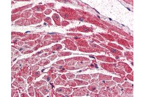 Anti-PIK3CA antibody IHC of human heart. (PIK3CA antibody  (AA 878-891))