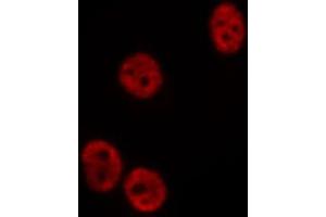 ABIN6275194 staining  COLO205 cells by IF/ICC. (Msx2/Hox8 antibody  (Internal Region))