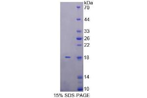 SDS-PAGE analysis of Rat KLRK1 Protein. (KLRK1 Protein)