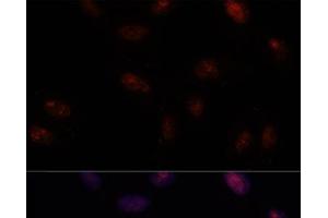 Immunofluorescence analysis of U-2 OS cells using SF3B1 Polyclonal Antibody at dilution of 1:100. (SF3B1 antibody)