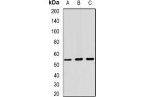 Western blot analysis of RNF81 expression in A549 (A), SW620 (B), HT29 (C) whole cell lysates.