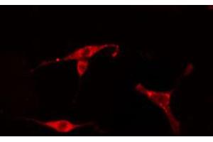 ABIN6274771 staining HeLa cells by IF/ICC. (RPL18 antibody)