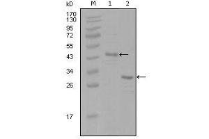 Western blot analysis using ESR1 mouse mAb against truncated Trx-ESR1 recombinant protein (1) and truncated ESR1(aa130-339)-His recombinant protein (2). (Estrogen Receptor alpha antibody)