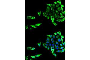 Immunofluorescence analysis of U2OS cells using GOT1 antibody (ABIN6131239, ABIN6141283, ABIN6141284 and ABIN6221514).