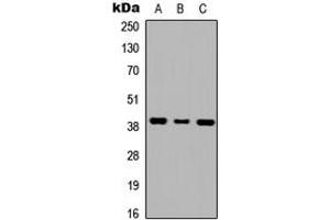 Western blot analysis of GALR1 expression in HEK293T (A), NS-1 (B), H9C2 (C) whole cell lysates. (Galanin Receptor 1 antibody  (Center))