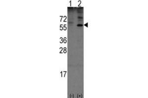 Western Blotting (WB) image for anti-Olfactomedin 1 (OLFM1) antibody (ABIN3001576)