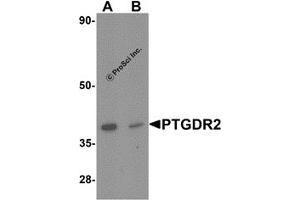 Western Blotting (WB) image for anti-Prostaglandin D2 Receptor 2 (PTGDR2) antibody (ABIN1077429) (Prostaglandin D2 Receptor 2 (PTGDR2) antibody)