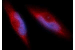 Immunofluorescence (IF) image for anti-Integrin beta 1 (ITGB1) (AA 21-461) antibody (PE) (ABIN5566385)