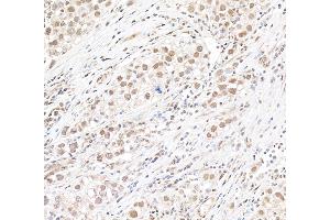 anti-MLLT1, super elongation complex subunit (MLLT1) (AA 325-375) antibody