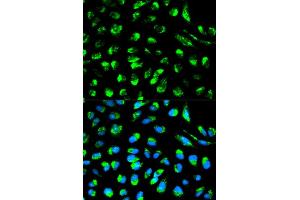 Immunofluorescence analysis of HeLa cells using ECI1 antibody. (DCI antibody)