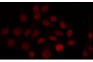 ABIN6266978 staining HuvEc by IF/ICC. (SIX Homeobox 6 antibody  (Internal Region))