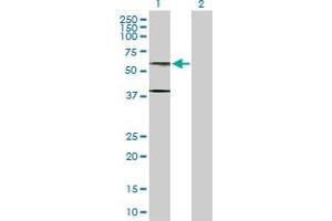 Western Blot analysis of AHCYL1 expression in transfected 293T cell line by AHCYL1 MaxPab polyclonal antibody. (AHCYL1 antibody  (AA 1-530))