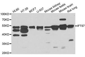 Western blot analysis of extracts of various cell lines, using IFT57 antibody. (IFT57 antibody  (AA 170-429))
