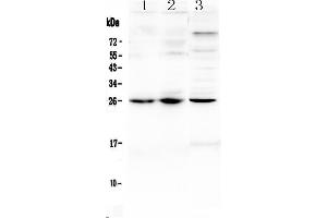 Western blot analysis of TREM1 using anti-TREM1 antibody . (TREM1 antibody  (AA 21-202))