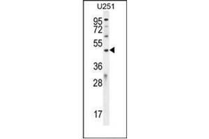 Western blot analysis of IPCEF1 / PIP3-E Antibody (C-term) in U251 cell line lysates (35ug/lane). (ICEF1 antibody  (C-Term))