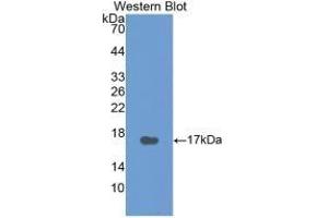 Detection of Recombinant CT, Human using Monoclonal Antibody to Calcitonin (CT) (Calcitonin antibody  (AA 85-116))