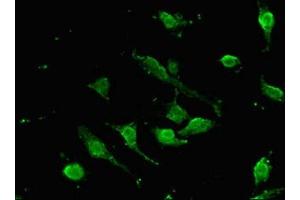 Immunofluorescent analysis of U251 cells using ABIN7172642 at dilution of 1:100 and Alexa Fluor 488-congugated AffiniPure Goat Anti-Rabbit IgG(H+L) (SOX9 antibody  (AA 296-501))