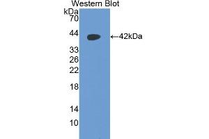 Detection of Recombinant PTH, Mouse using Polyclonal Antibody to Parathyroid Hormone (PTH) (PTH antibody  (AA 26-115))