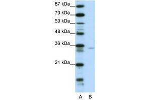 Western Blot showing ZNF177 antibody used at a concentration of 1-2 ug/ml to detect its target protein. (ZNF177 antibody  (N-Term))