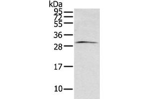 Gel: 12 % SDS-PAGE, Lysate: 40 μg, Lane: Mouse brain tissue, Primary antibody: ABIN7193096(ZFAND2B Antibody) at dilution 1/200 dilution, Secondary antibody: Goat anti rabbit IgG at 1/8000 dilution, Exposure time: 1 minute (ZFAND2B antibody)