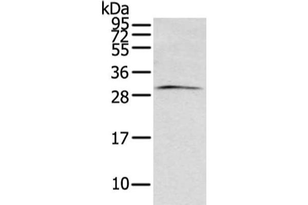 ZFAND2B 抗体