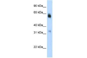 WB Suggested Anti-JMJD2D Antibody Titration:  0.