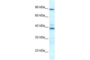 Western Blotting (WB) image for anti-T-Box 5 (TBX5) antibody (ABIN2460713) (T-Box 5 antibody)