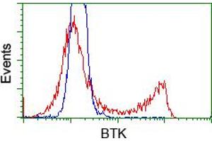 Image no. 4 for anti-Bruton Agammaglobulinemia tyrosine Kinase (BTK) antibody (ABIN1496973) (BTK antibody)