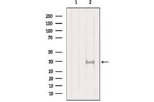 Western blot analysis of extracts from HepG2, using SULT1A1  Antibody. (SULT1A1 antibody  (Internal Region))