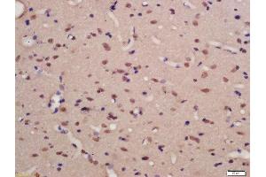 Formalin-fixed and paraffin embedded rat brain labeled with Rabbit Anti-TNIK (Ser769) Polyclonal Antibody, Unconjugated (ABIN711956) at 1:200 followed by conjugation to the secondary antibody and DAB staining (TNIK antibody  (pSer769))