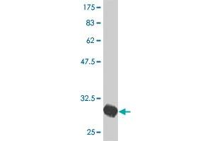 Western Blot detection against Immunogen (31. (HTR2C antibody  (AA 1-52))