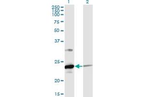 Western Blot analysis of UBE2T expression in transfected 293T cell line by UBE2T monoclonal antibody (M02), clone 4G1-4C2. (Ube2t antibody  (AA 1-197))