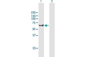 Western Blot analysis of CCT8L2 expression in transfected 293T cell line by CCT8L2 MaxPab polyclonal antibody. (CCT8L2 antibody  (AA 1-557))