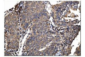 IHC analysis of AS160/TBC1D4 using anti-AS160/TBC1D4 antibody (ABIN7599745). (TBC1D4 antibody  (AA 1118-1298))