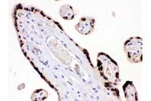 Immunohistochemistry (IHC) image for anti-High Mobility Group Box 3 (HMGB3) (AA 62-95), (N-Term) antibody (ABIN3042447)