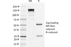 SDS-PAGE Analysis Purified IL3RA/CD123 Mouse Monoclonal Antibody (IL3RA/1531). (IL3RA antibody  (AA 26-171))