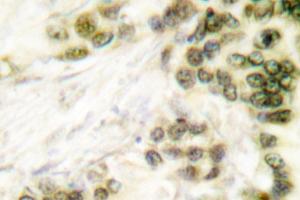 Image no. 2 for anti-Transcription Factor AP-2 alpha (Activating Enhancer Binding Protein 2 Alpha) (TFAP2A) antibody (ABIN265311)