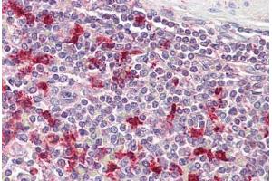 Anti-PTMA antibody IHC staining of human spleen. (PTMA antibody  (AA 89-101))