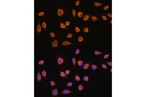 Immunofluorescence analysis of L929 cells using SLC20 antibody (ABIN1682754, ABIN3018562, ABIN3018563 and ABIN6220499) at dilution of 1:100. (SLC20A1 antibody  (AA 257-356))