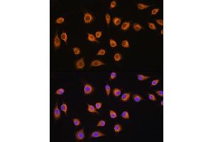 Immunofluorescence analysis of L929 cells using SLC20 antibody (ABIN1682754, ABIN3018562, ABIN3018563 and ABIN6220499) at dilution of 1:100.