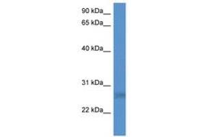 Image no. 1 for anti-SplA/ryanodine Receptor Domain and SOCS Box Containing 2 (SPSB2) (AA 51-100) antibody (ABIN6746865)