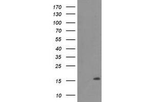 Western Blotting (WB) image for anti-Chromosome 20 Open Reading Frame 30 (C20orf30) antibody (ABIN1498766)