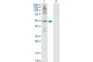 Western Blot analysis of ETF1 expression in transfected 293T cell line by ETF1 monoclonal antibody (M02), clone 2H4. (ETF1 antibody  (AA 338-437))